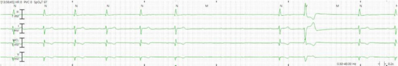 Figure 2