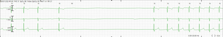 Figure 3