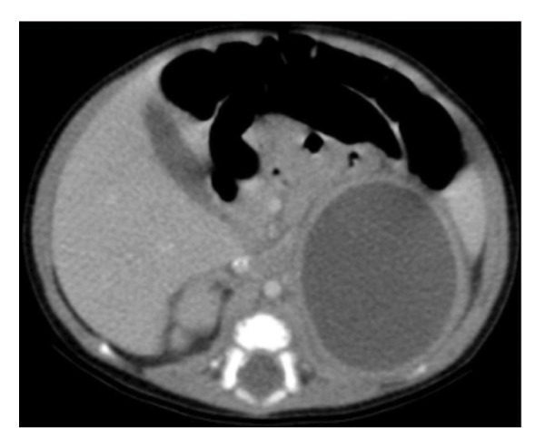 FIGURE 2
