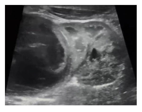 FIGURE 3