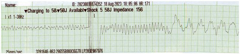 FIGURE 3