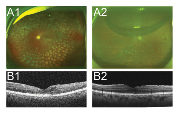 FIGURE 3