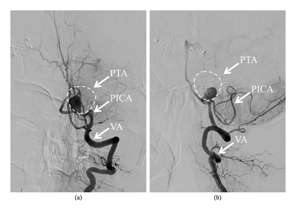 FIGURE 3