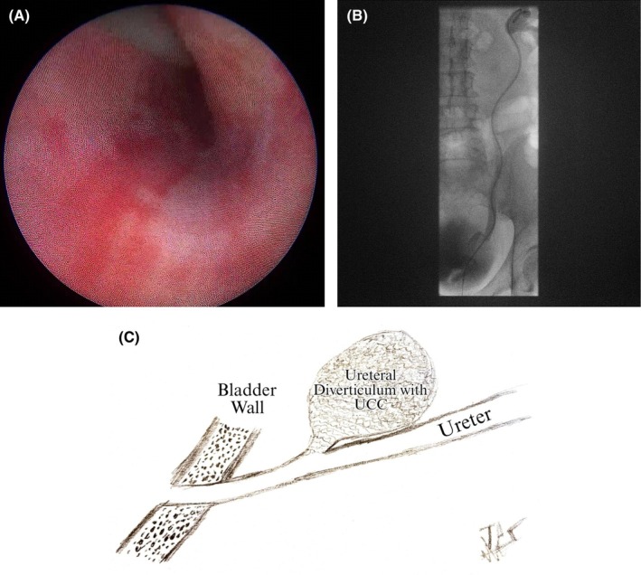 FIGURE 2