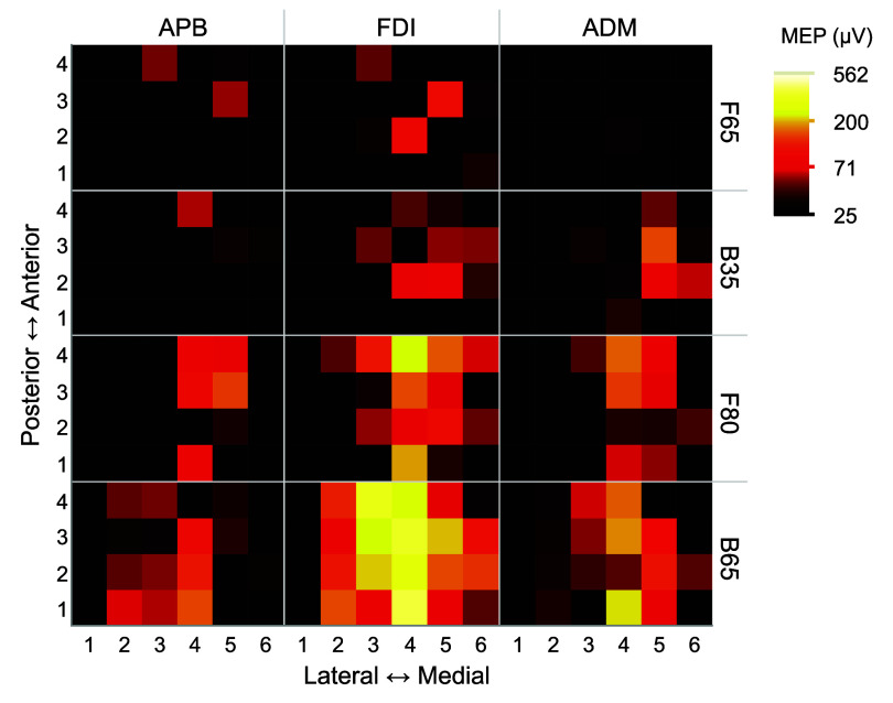 Figure 20