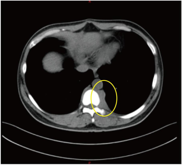 Figure 2