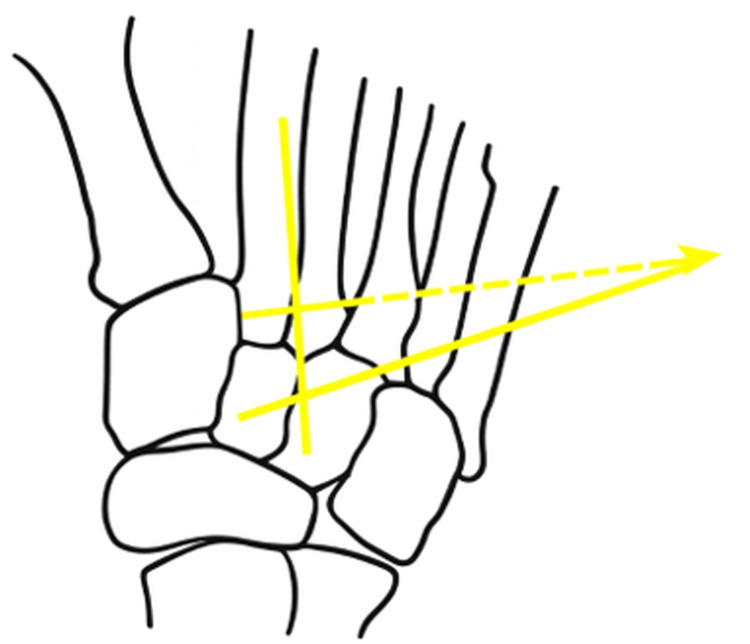 Figure 9