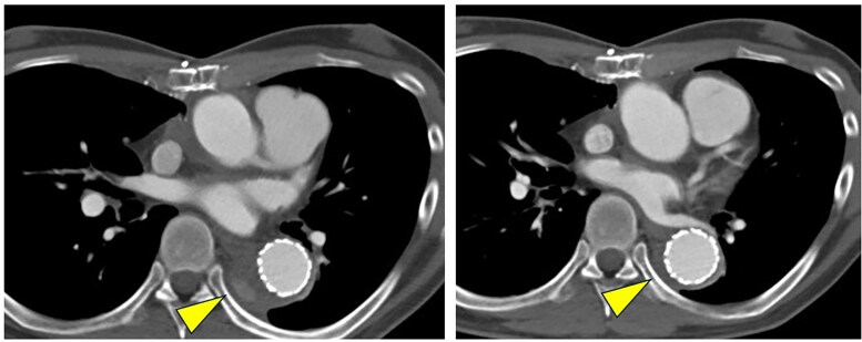 Figure 4