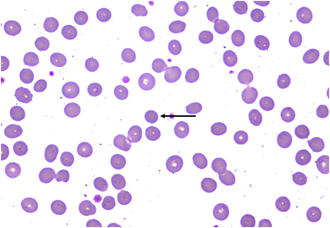 Figure 1