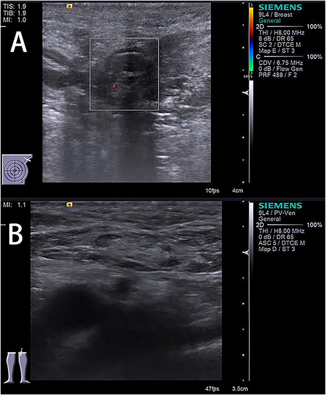 Figure 3