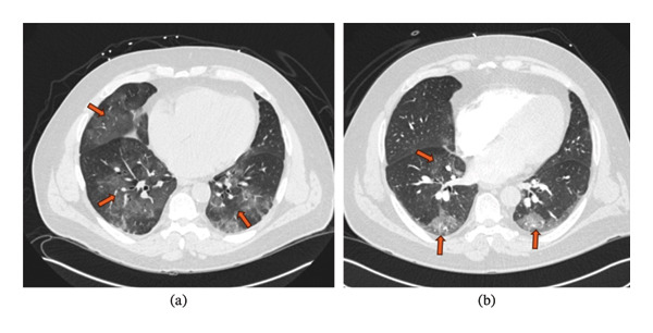 FIGURE 1