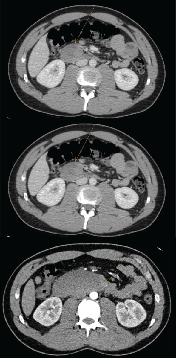 Figure 1
