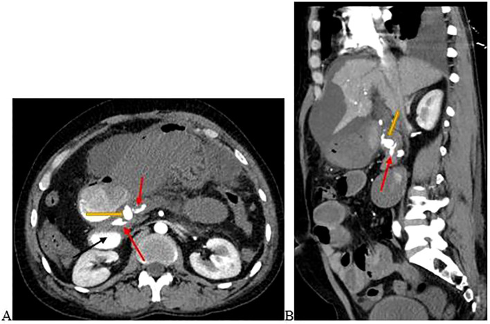 Figure 1