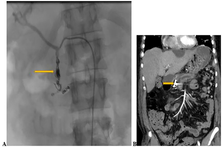 Figure 2