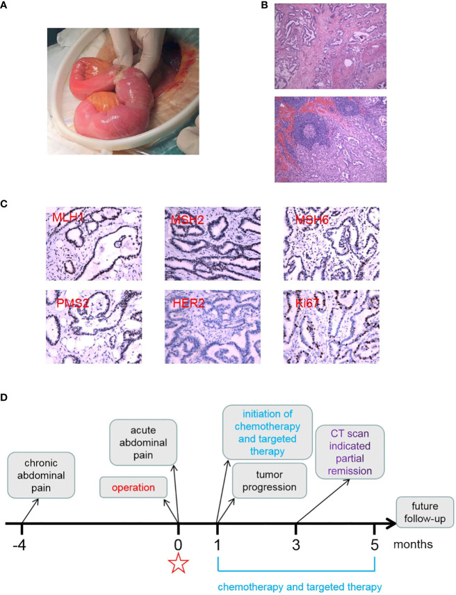Figure 2