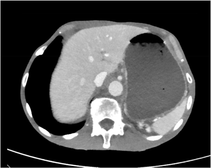 Figure 1