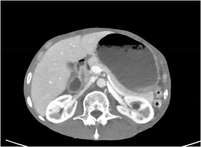 Figure 2