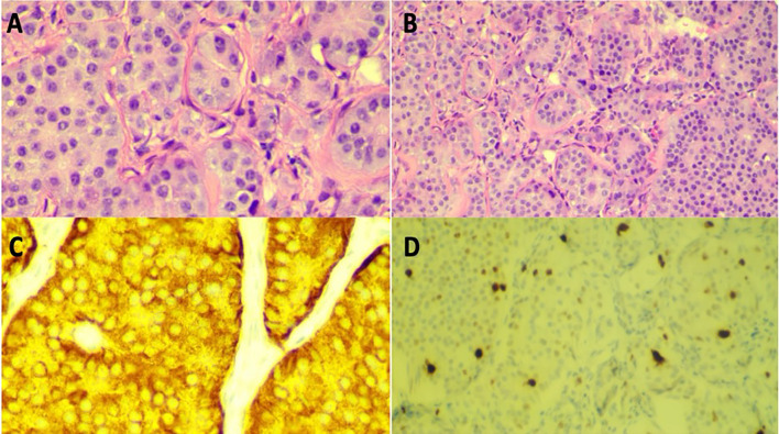 Figure 2