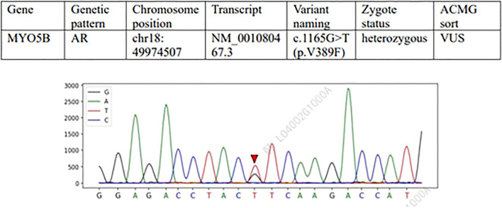 Figure 2