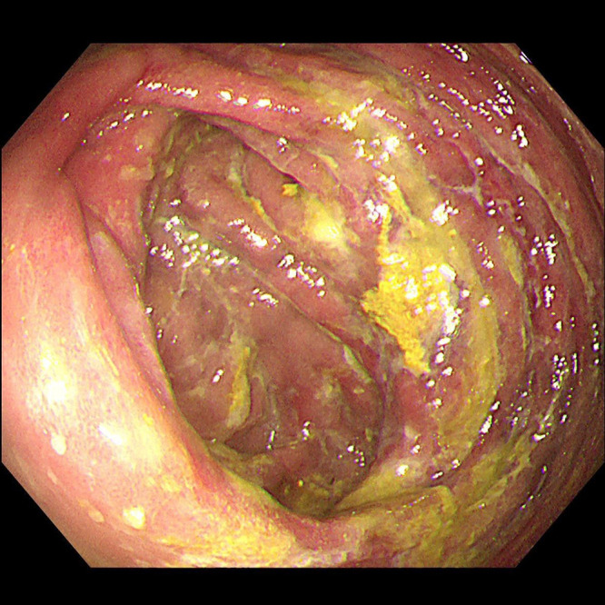 Figure 4