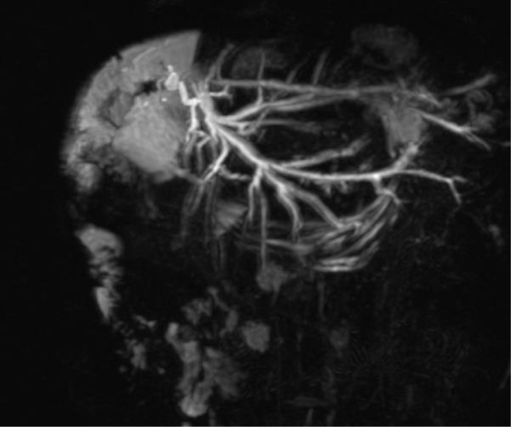 Figure 2