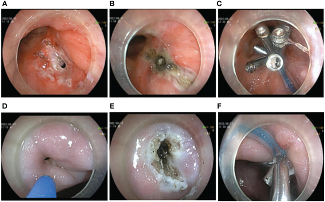 Figure 2