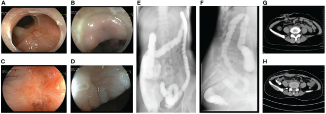 Figure 3