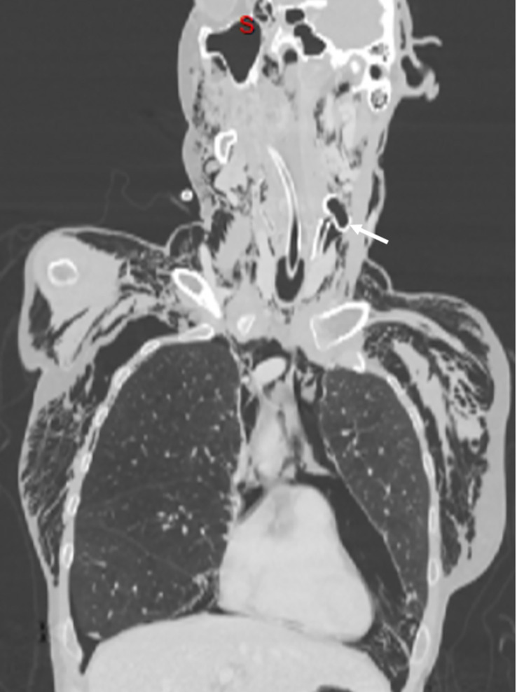 Figure 1