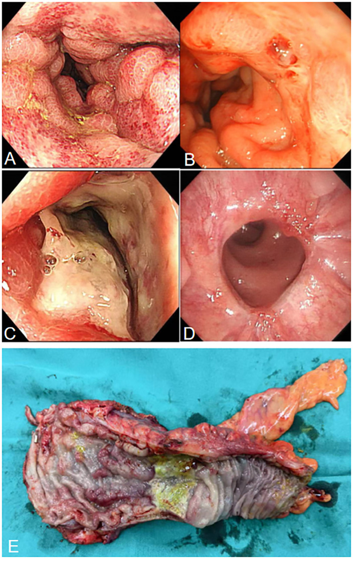 Figure 2