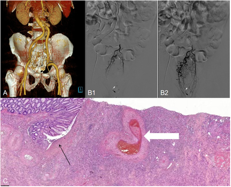 Figure 3
