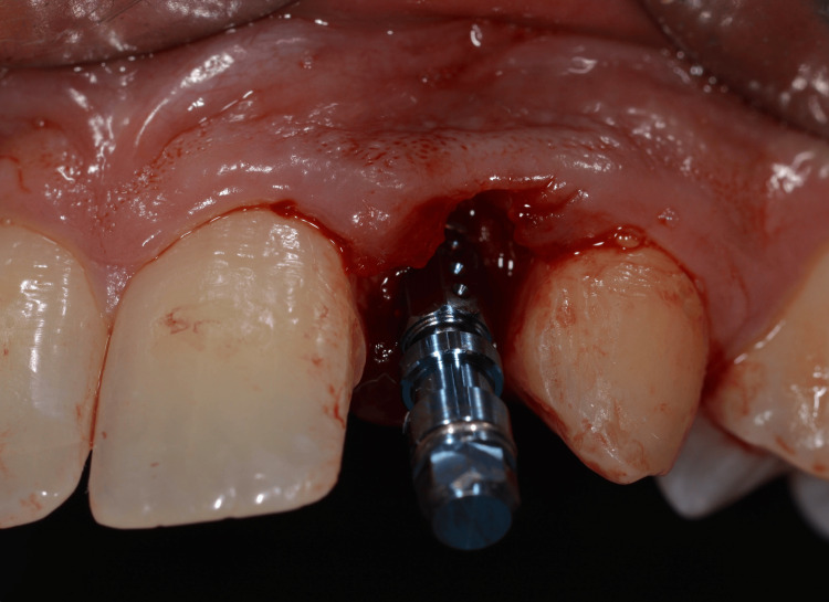 Figure 13