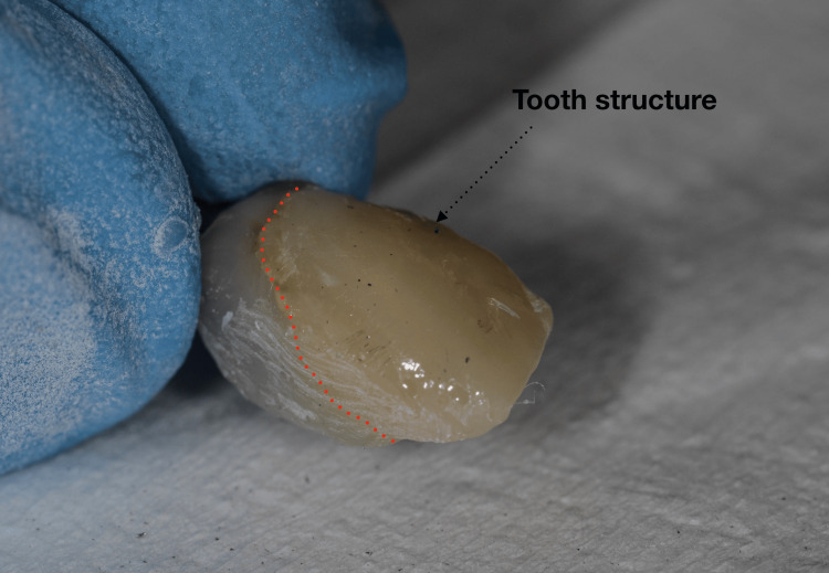 Figure 15