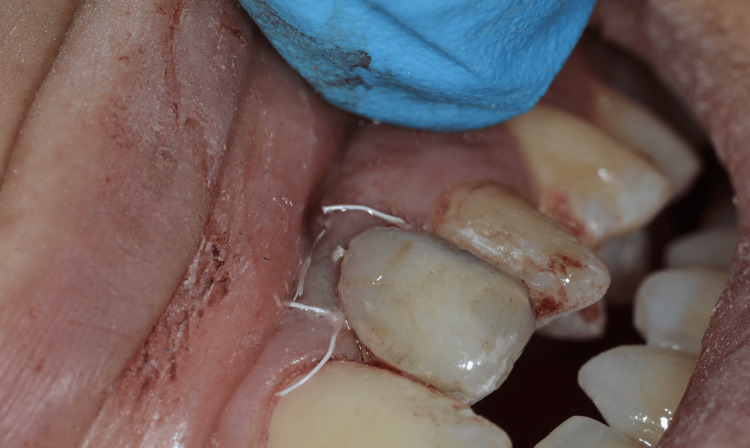 Figure 16