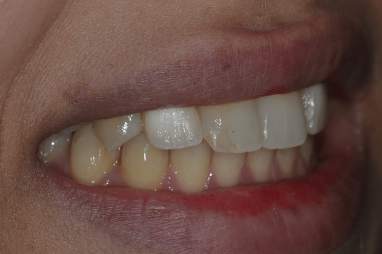 Figure 18