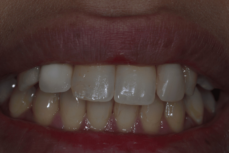 Figure 19