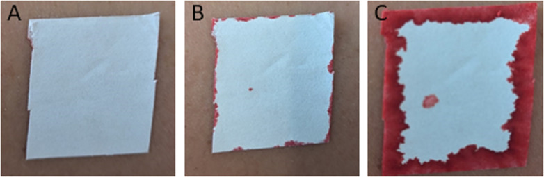Fig 4