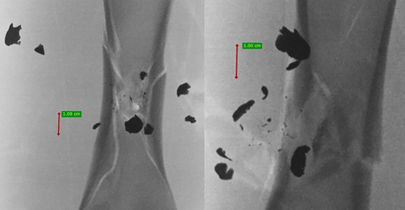 Fig 14