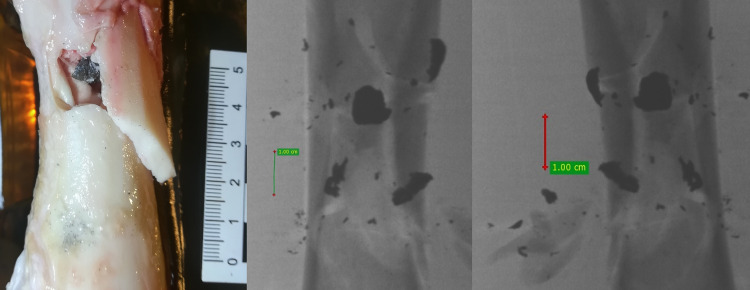 Fig 16