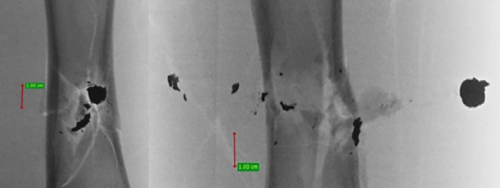 Fig 22