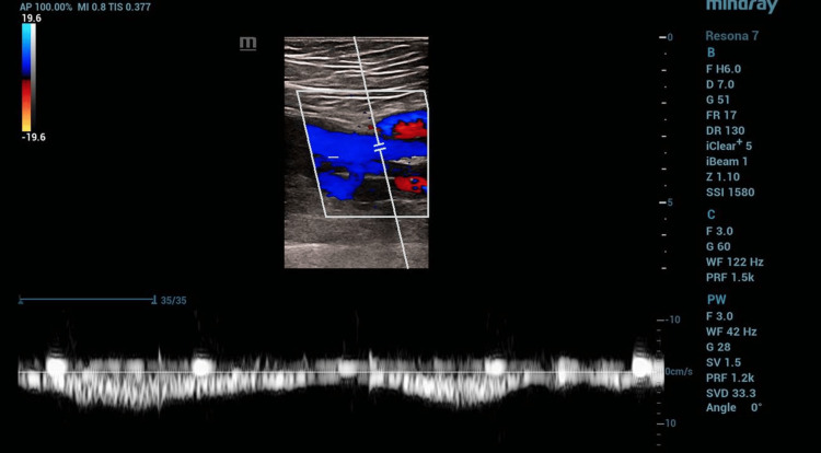 Figure 5