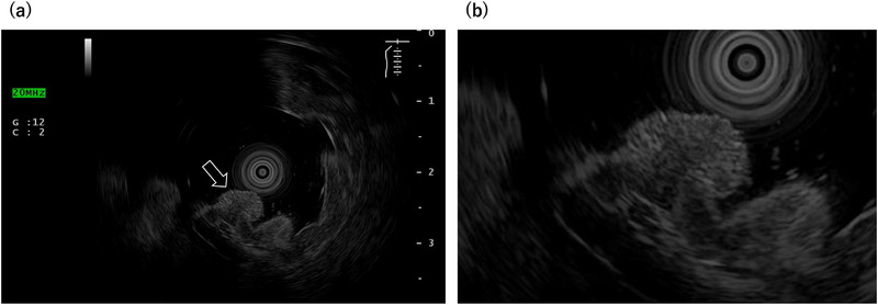 FIGURE 2