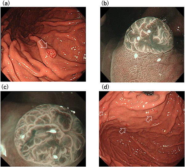 FIGURE 1