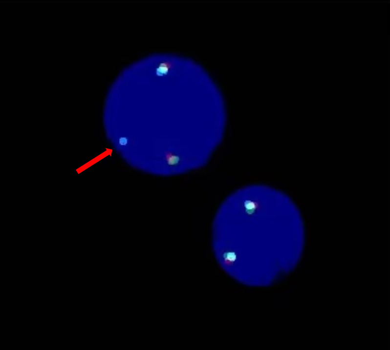 Figure 2
