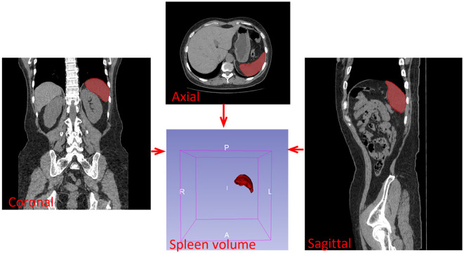 Figure 1