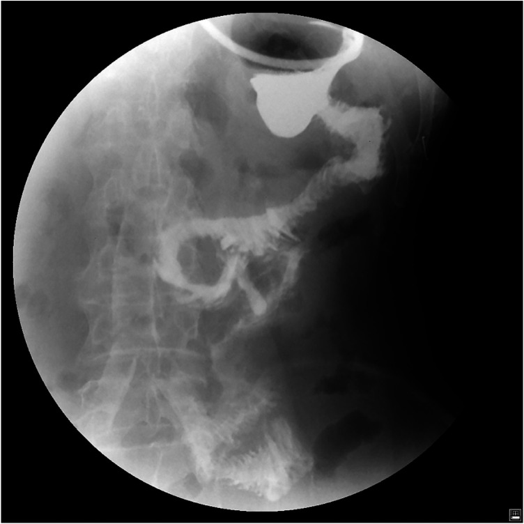 Figure 1