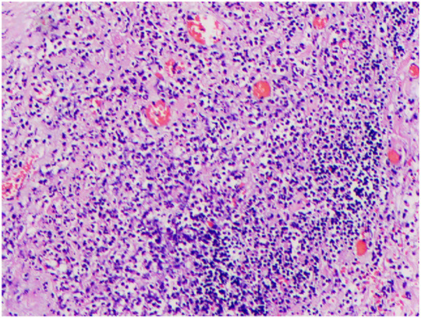 Figure 3