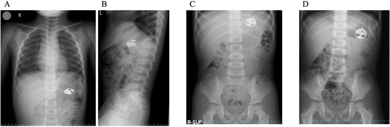 Figure 1