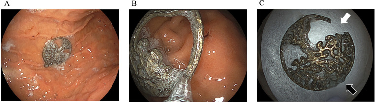 Figure 2
