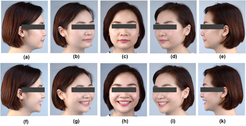 Figure 1