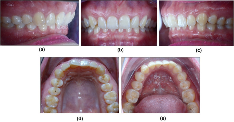 Figure 2